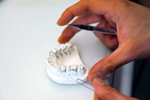 Kieferorthopädie KFO Remagen Sinzig Dr Kroll Dr Vieweg