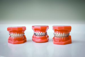 Kieferorthopädie KFO Remagen Sinzig Dr Kroll Dr Vieweg